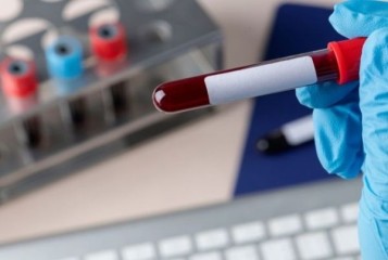 Empresa de cruzeiros é condenada por exigir teste de HIV para contratação de garçom