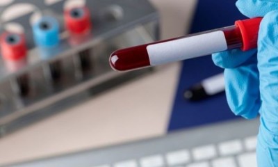 Empresa de cruzeiros é condenada por exigir teste de HIV para contratação de garçom