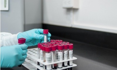 Empresa pública terá de reintegrar e indenizar empregado soropositivo